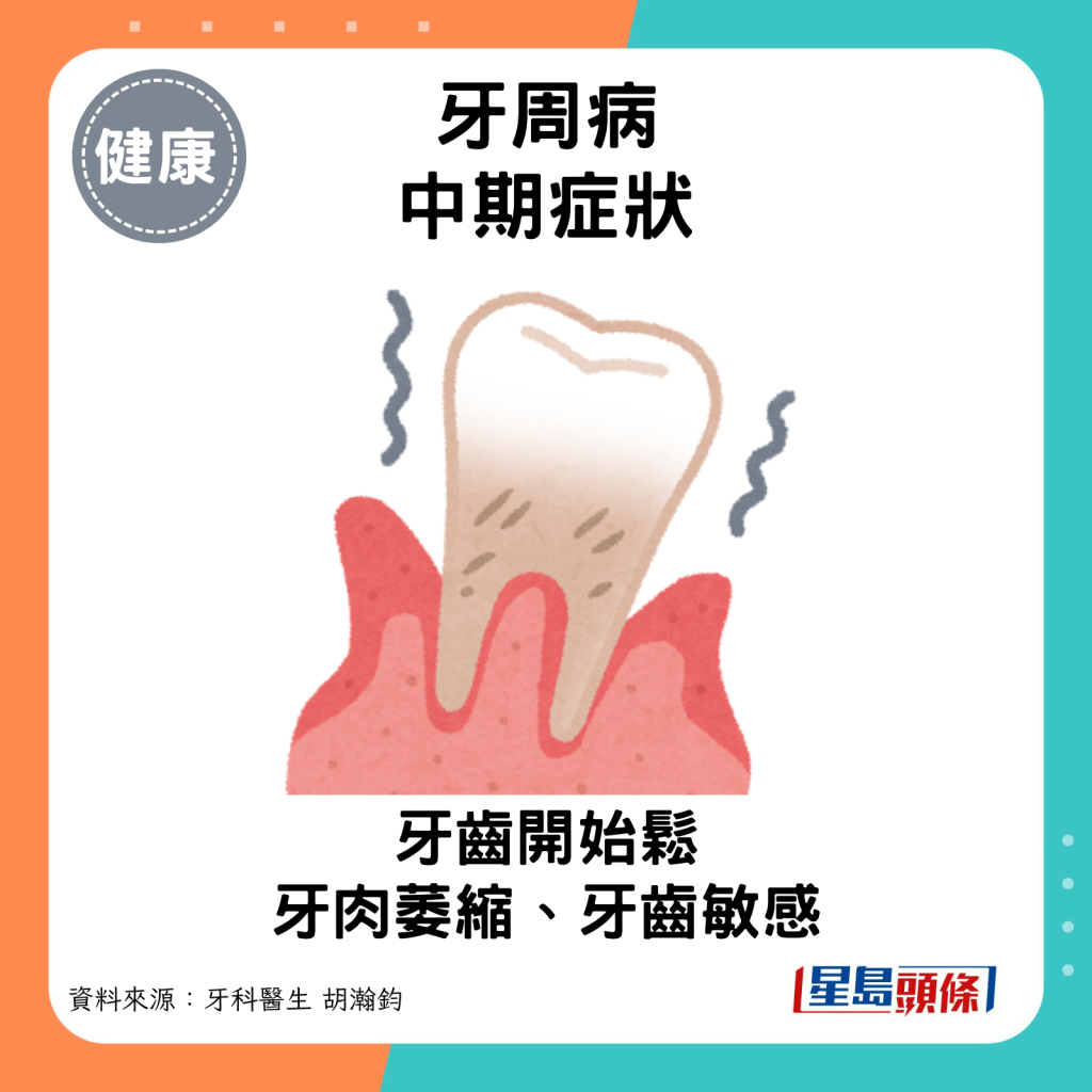 牙周病中期症状：牙肉萎缩。