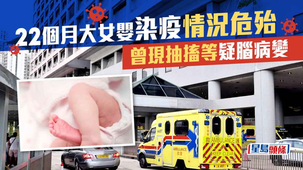 一名22個月大女嬰染疫,現時情況危殆。資料圖片