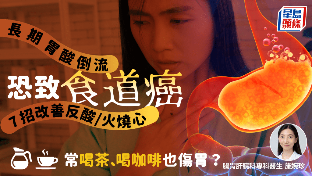 长期胃酸倒流恐灼伤食道致癌 医生教7招改善反酸/火烧心 常喝茶喝咖啡也伤胃？
