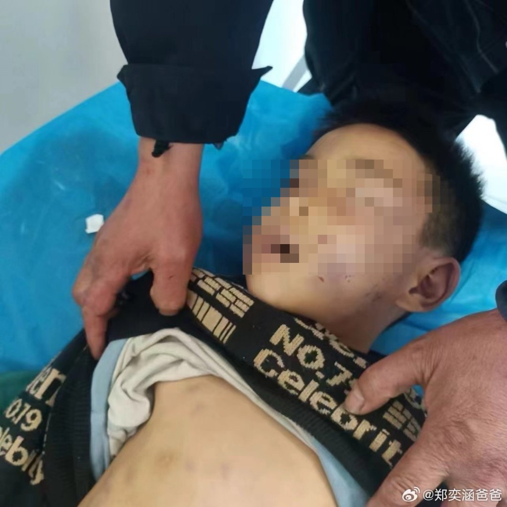 山東5歲男童涵涵，日前疑遭母親及其男友虐打致死。