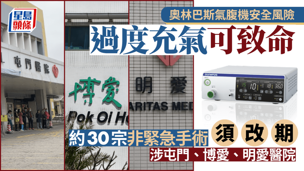 一款氣腹機過度充氣或現併發症  海外釀10傷1死  公院即時停用142部