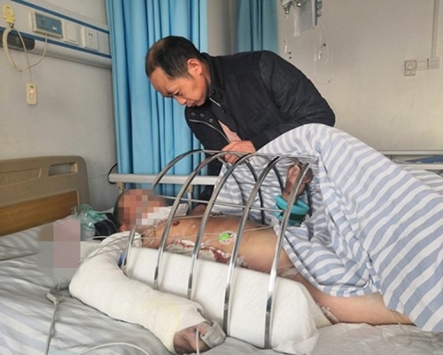 湖北一名80歲老翁殺豬賀壽,卻被瀕死肥豬踢進滾水鍋致嚴重燙傷。網圖