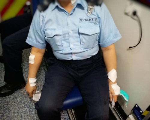 被腐液濺傷的執勤警。警方圖片
