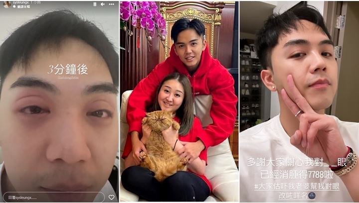 億萬駙馬丨伍富橋雙眼紅腫被老婆取笑夠「正能量」, 食物敏感康復進度向好。