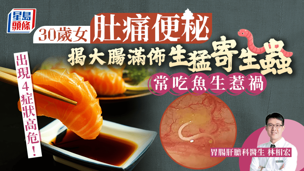 一名30歲女子經常肚痛便秘，服藥沒好轉，揭大腸滿佈寄生蟲。
