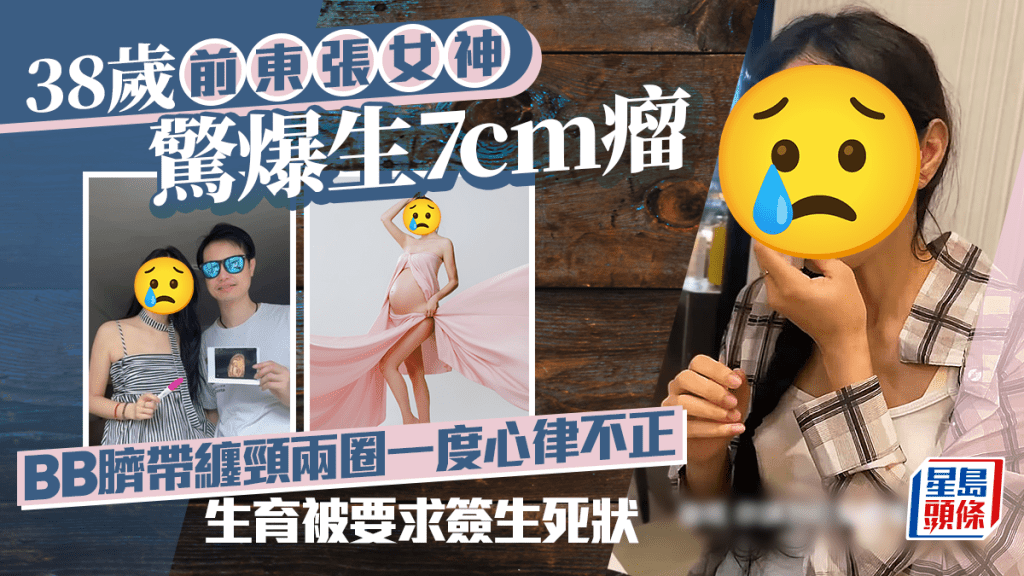38歲前東張女神驚爆生7cm瘤  BB臍帶纏頸兩圈一度心律不正  生育被要求簽生死狀