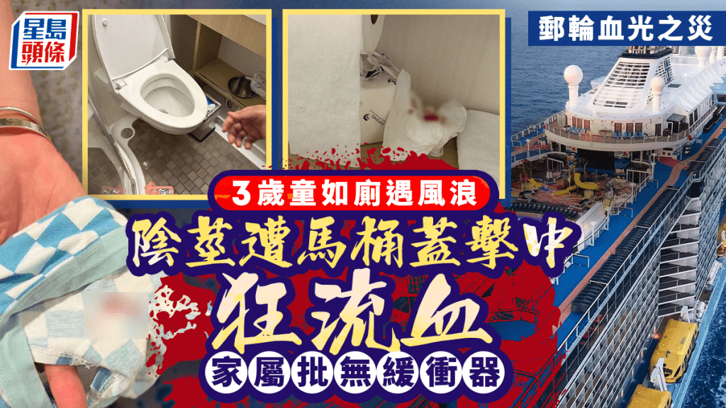 海洋光譜號︱3歲童如廁遇風浪馬桶蓋跌落  陰莖捱拍受創成褲血