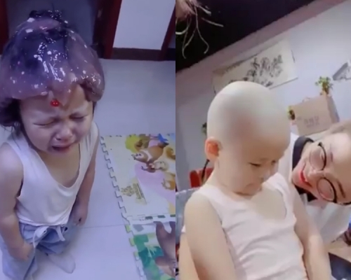 女孩玩「鬼口水」黏實頭髮需剃光頭。 網圖