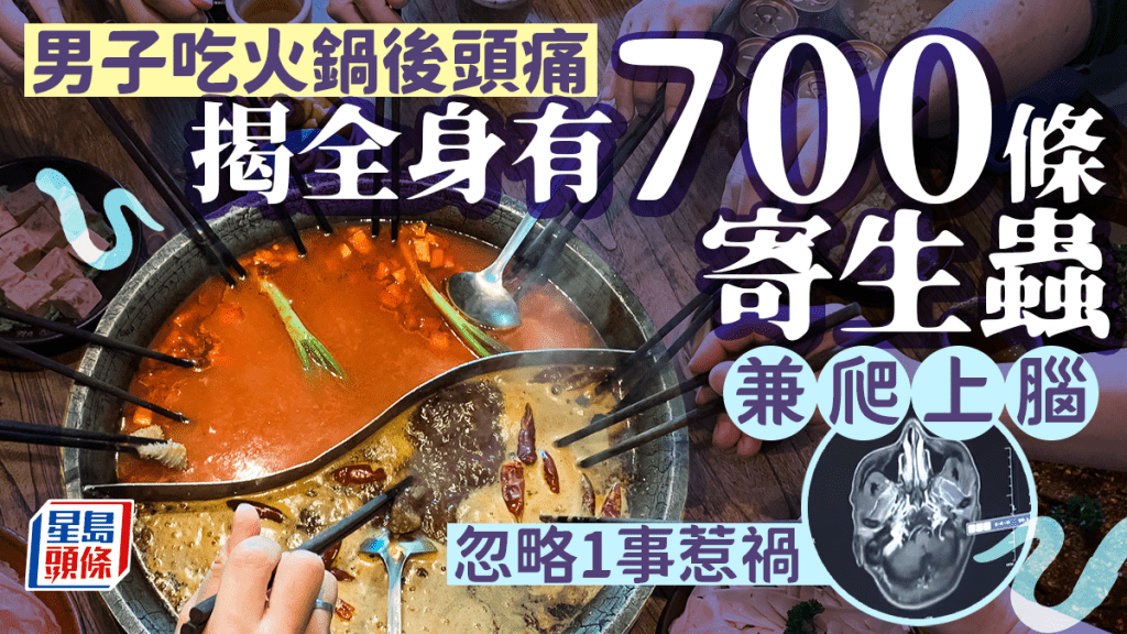 男子吃火鍋後頭痛 揭全身染700條寄生蟲兼上腦 忽略1事惹禍 附預防方法