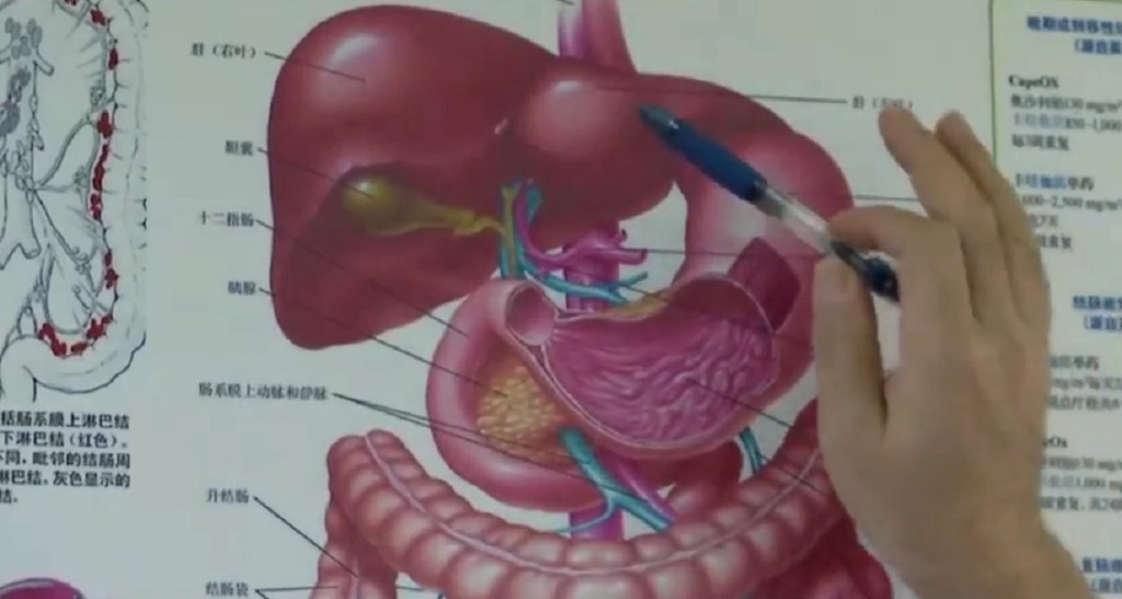 男病人平時喜歡健身，加上經常豪飲，腹腔壓力改變導致橫膈膜破裂。網上截圖