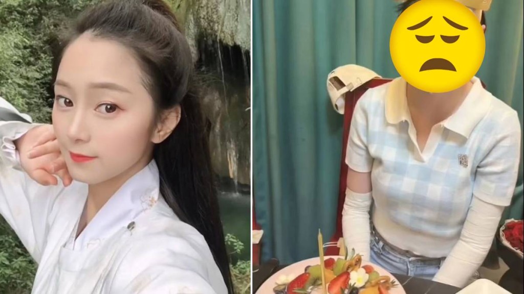 湖北女手机放枕边通宵叉电，因充电器爆炸烧伤7成皮肤毁容。抖音＠依依的抗疤分享