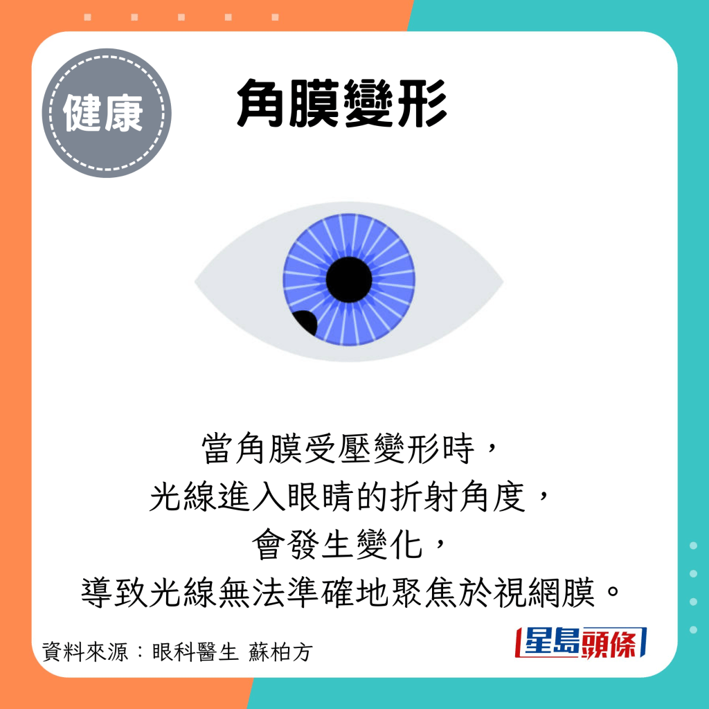 角膜變形：當角膜受壓變形時， 光線進入眼睛的折射角度， 會發生變化， 導致光線無法準確地聚焦於視網膜。