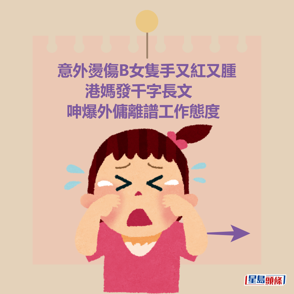 意外燙傷B女隻手又紅又腫 港媽發千字長文呻爆外傭離譜工作態度 意外燙傷B女隻手又紅又腫 港媽發千字長文呻爆外傭離譜工作態度