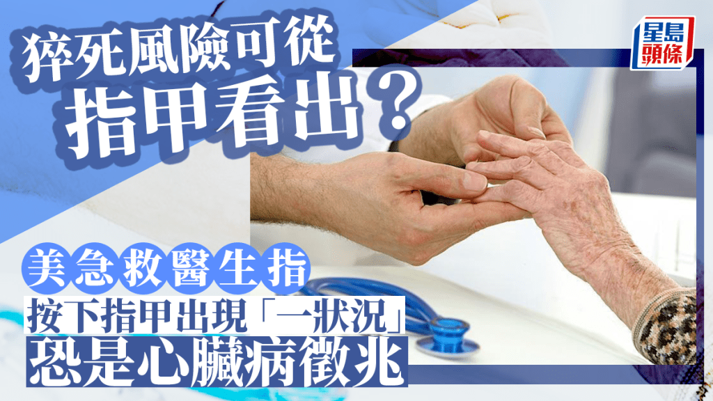 醫療專家稱只需簡單看看指甲 能知猝死風險