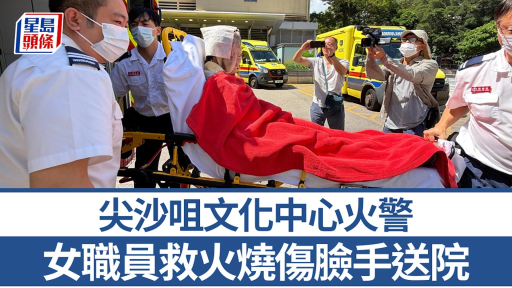 尖沙咀文化中心火警 1女職員燒傷臉手送院