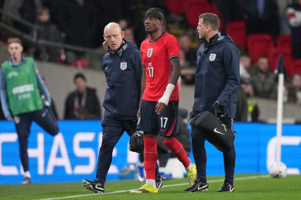 馬杜基於對烏拉圭的友賽中傷出。美聯社 馬杜基於對烏拉圭的友賽中傷出。美聯社