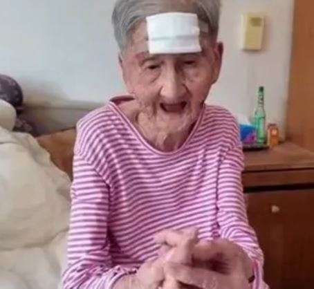 顧婆婆自行剪去額上犄角，險致大出血。長城新媒體