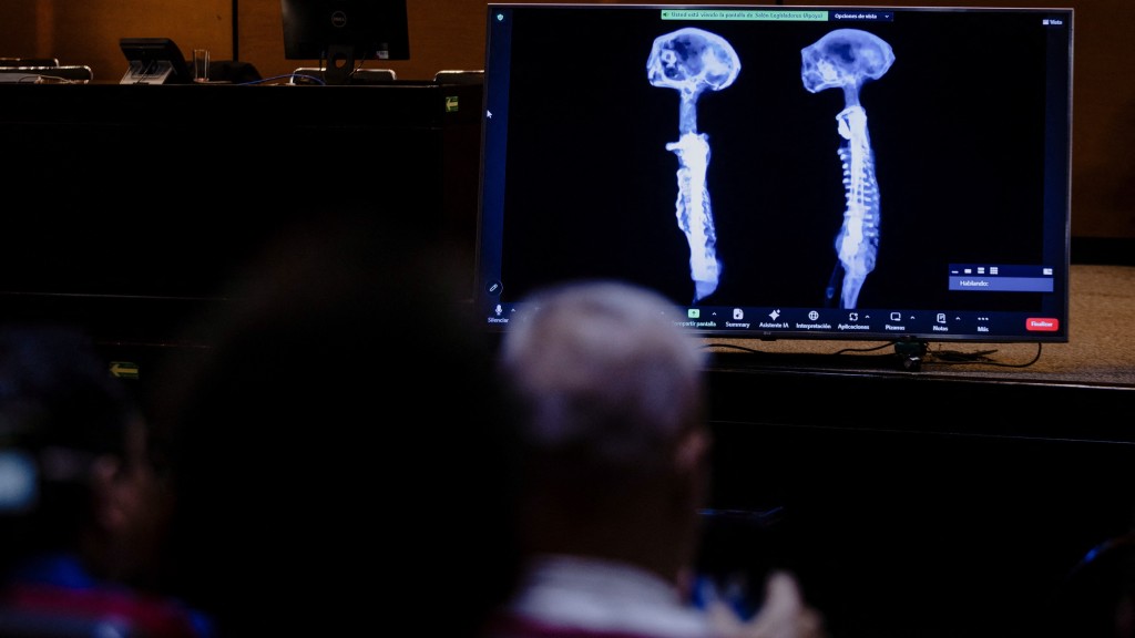 屏幕顯示「非人類」的X光片。 路透社