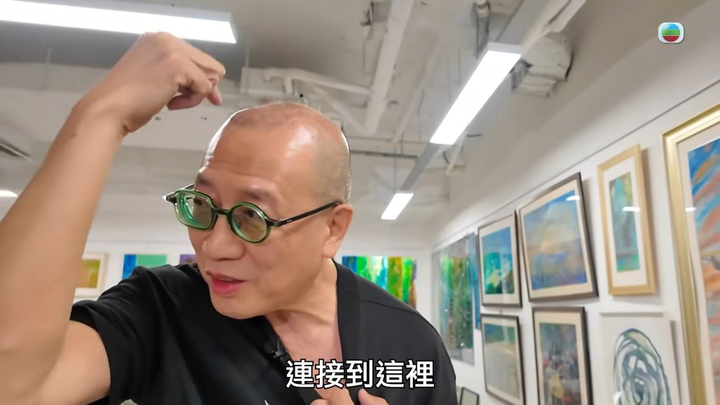 嚴秉泉醫生：「後去到呢度（頭頂），分開兩條，左右腦都有（起搏器）。」