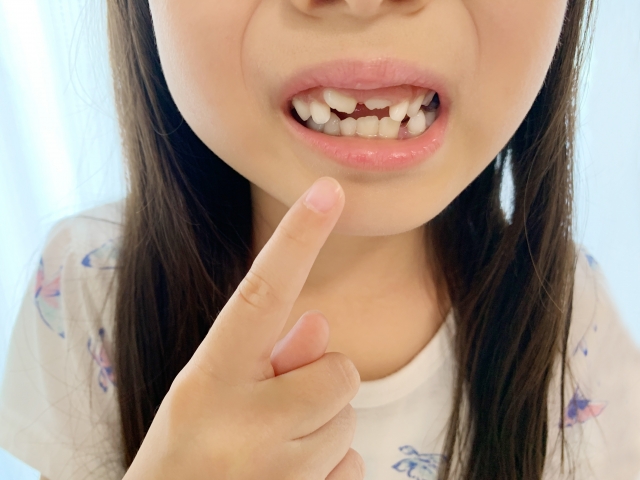 兒童箍牙（圖片來源：PhotoAC）
