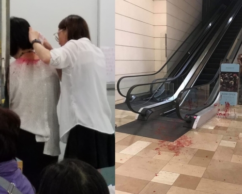 女子遭衣領及手部被紅油濺中,事發的電梯旁亦遺下油迹。李子平攝、網上圖片