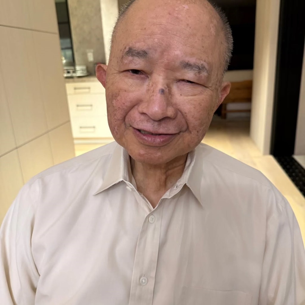 吳宇森的左眼似有撐不開的情況。 吳宇森的左眼似有撐不開的情況。