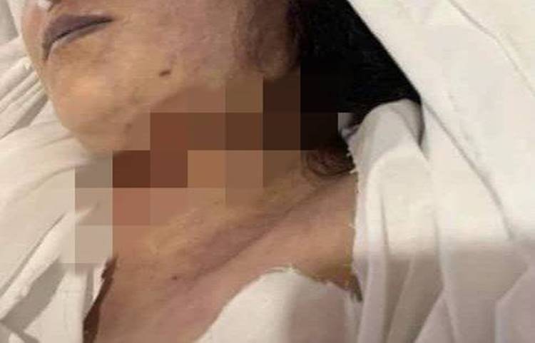 哈基米身首雖被駁回,但頸部亦有一道明顯的切痕。互聯網圖片