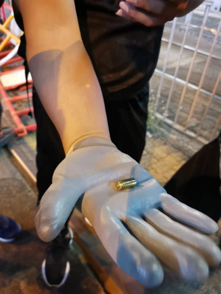 元朗有示威者中槍。張秀賢facebook圖片
