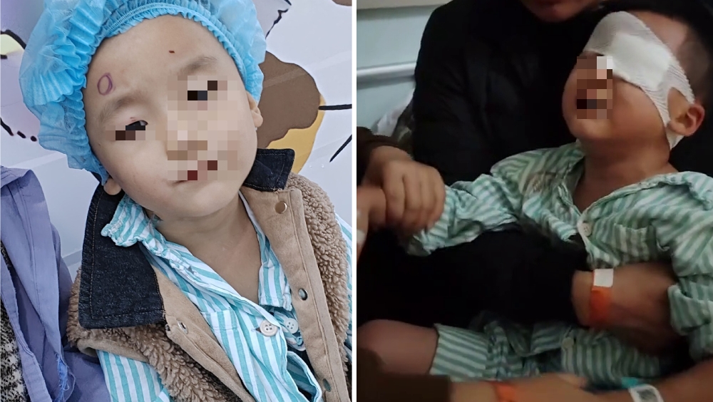 5歲幼童被同學戳傷左眼,老師竟塗豬油致感染失明。 5歲幼童被同學戳傷左眼,老師竟塗豬油致感染失明。