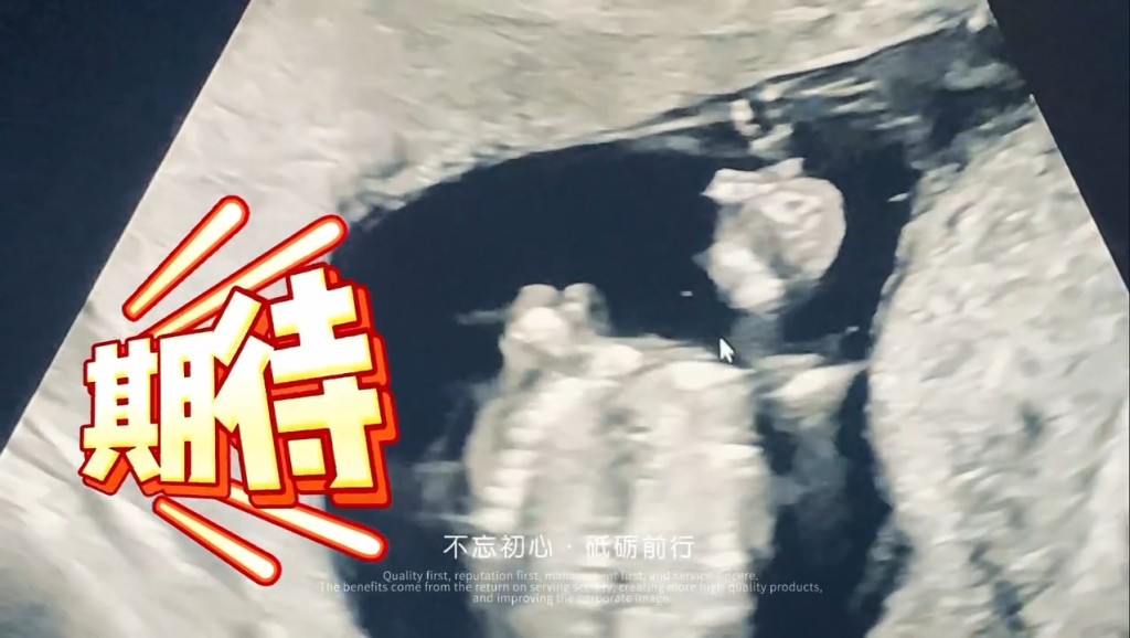 「屯門娜娜」期待BB的來臨。