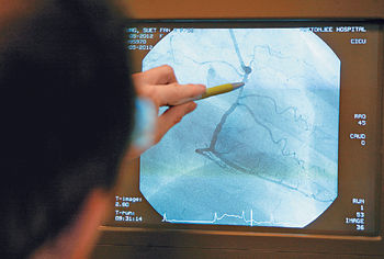 ■冠心病是本港第二號殺手，當病人冠狀動脈出現阻塞時，需考慮進行通波仔手術。