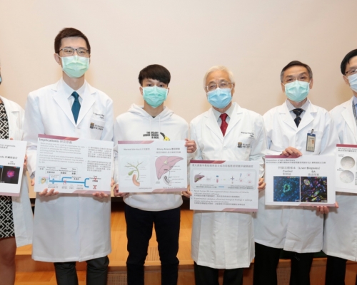 港大醫學院發現β-澱粉樣蛋白異常沉積是膽道閉塞的新發病機制。港大醫學院圖片