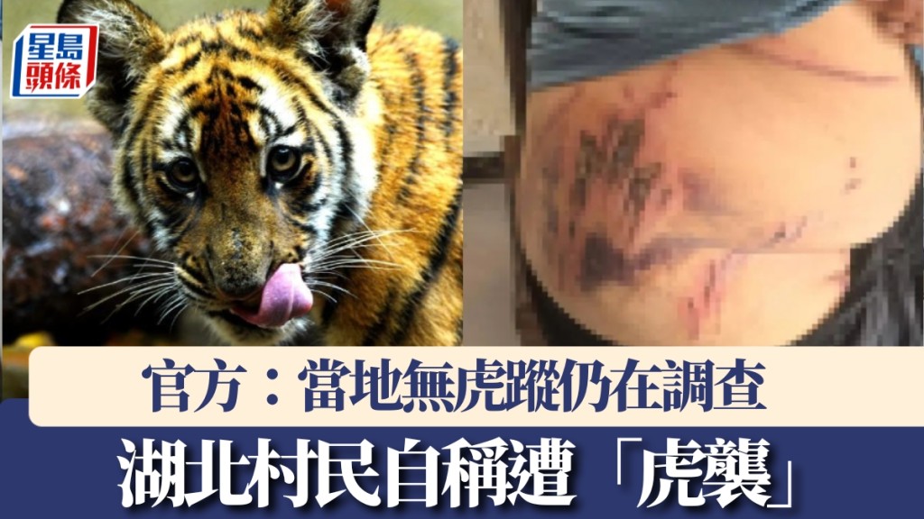湖北鶴峰村民曬背部傷痕，自稱被老虎襲擊。新華社/網圖