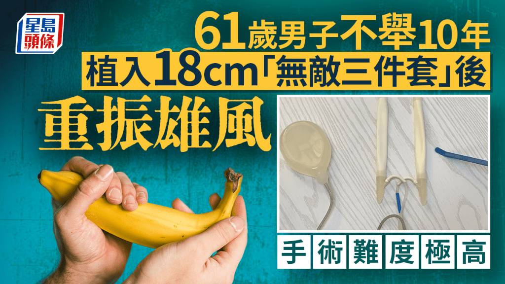 深圳六旬漢十年不舉終有救 植入18cm「秘密武器」重振雄風