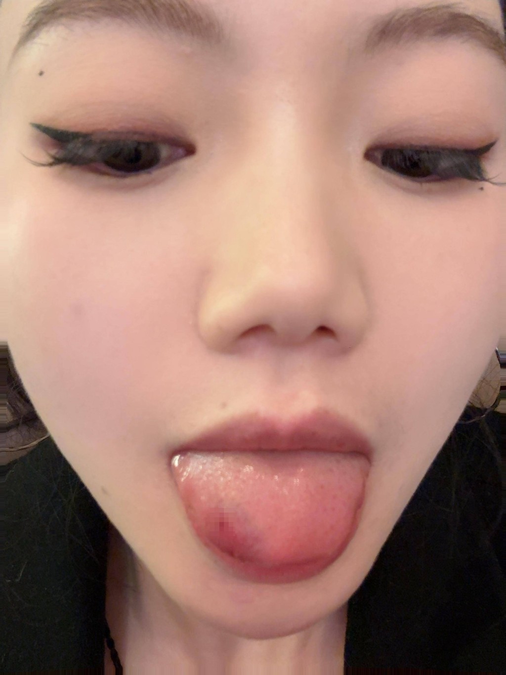 羅小姐吃黃辣丁魚時被其背鯺硬刺插入舌頭,連跑3間醫院才成功「拔骨」。抖音@獨美 羅小姐吃黃辣丁魚時被其背鯺硬刺插入舌頭,連跑3間醫院才成功「拔骨」。抖音@獨美