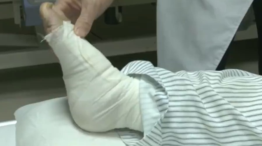 王叔獲醫生允許一邊做手術一邊打機。廣東電視台