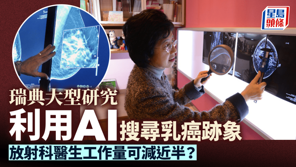 研究:用AI搵乳癌跡象 醫生工作量減近半