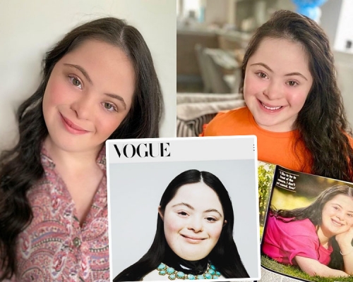 18歲女孩艾麗是唐氏綜合症患者。 Ellie Goldstein IG圖