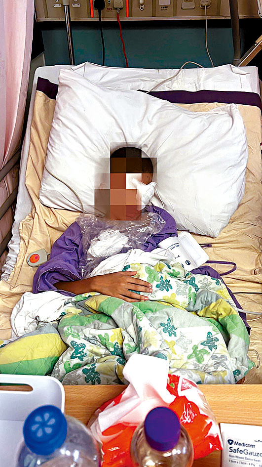 13歲穆斯林男童眼睛嚴重受傷,須進行手術修復。