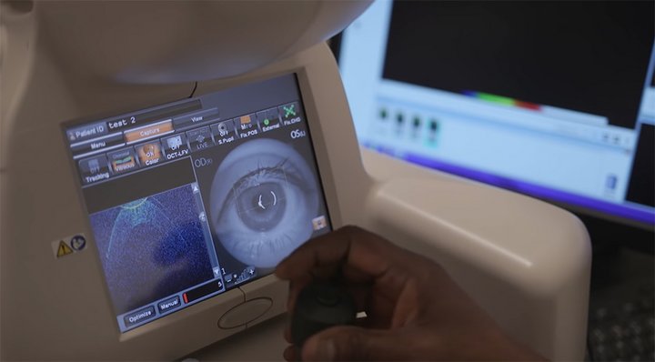 最新的光學相干斷層掃描(OCT)技術，檢測青光眼準確度很高。