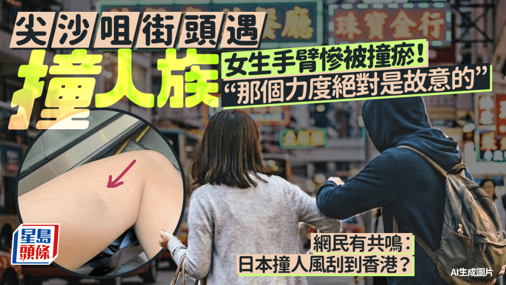 女生尖沙咀街頭遇「撞人族」！手臂慘被撞瘀︰那力度絕對是故意的 網民有共鳴︰日本撞人風刮到香港？
