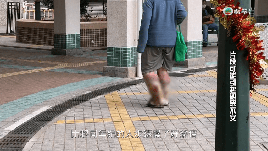 《东张西望》拍到街坊投诉的邻居，即使已经远距离拍摄加打格，但亦能清楚见到其双腿异常肿胀，皮肉严重腐烂。