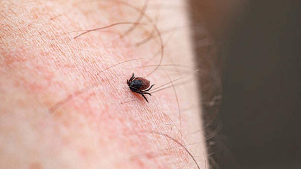 遊日注意｜日本蜱蟲病感染人數創歷史新高 可致器官衰竭死亡率達30% 被蜱蟲叮咬應如何處理？