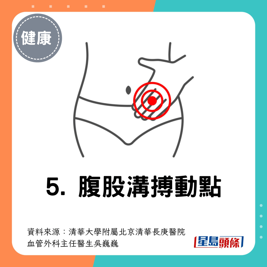 5. 腹股沟搏动点