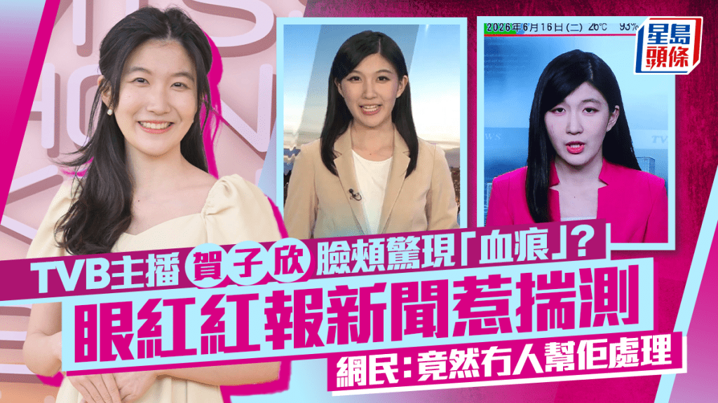 TVB主播賀子欣報新聞驚見臉頰「血痕」  眼紅紅出鏡惹網民揣測背後原因：竟然冇人幫佢處理