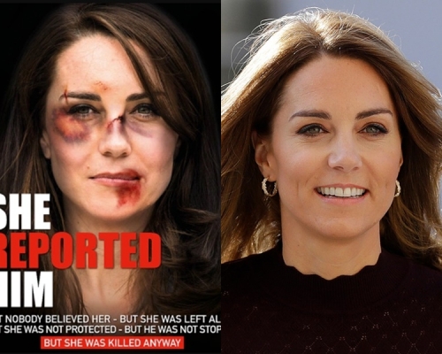 凱特(右)被改圖製成家暴受害者(左)。網圖/AP