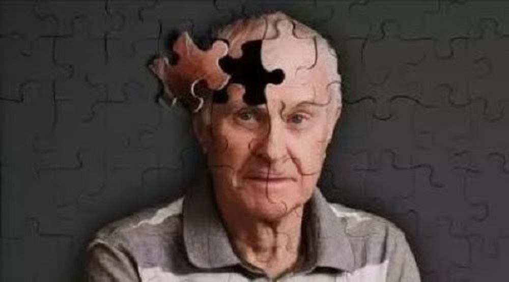 老年痴呆症是老人殺手之一。