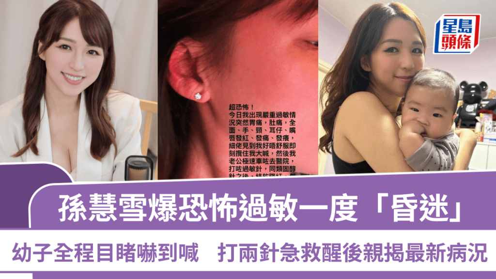 孙慧雪爆恐怖过敏一度「昏迷」  幼子全程目睹吓到喊  打两针急救醒后亲揭最新病况