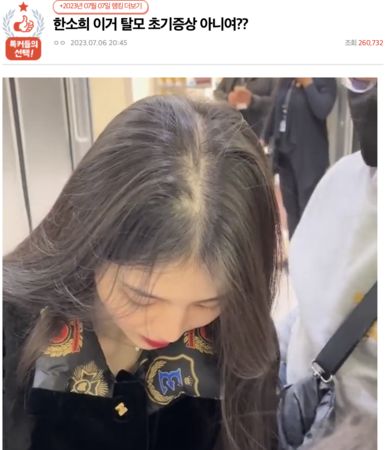 韓國論壇出現以「韓韶禧這是掉髮初期徵兆嗎」做標題的文章。