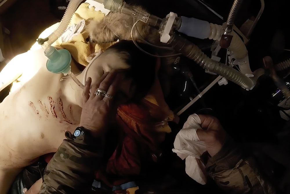 女軍醫拍下的片段紀錄了受傷的烏克蘭小男孩回天乏術。AP